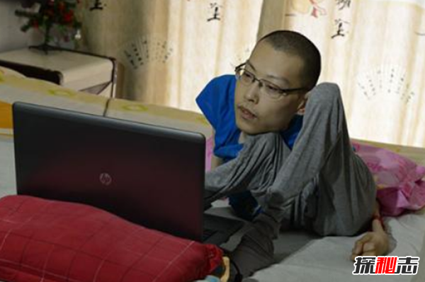 漸凍癥會遺傳下一代嗎?漸凍人最典型的十大癥狀
